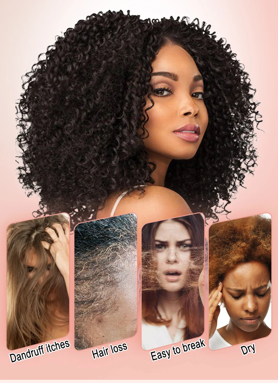 Naturals Anti-Hair Loss Oil Super 5x set African fast hair growth Chebe Batana oil butter  Fenugreek hair regrowth treatment