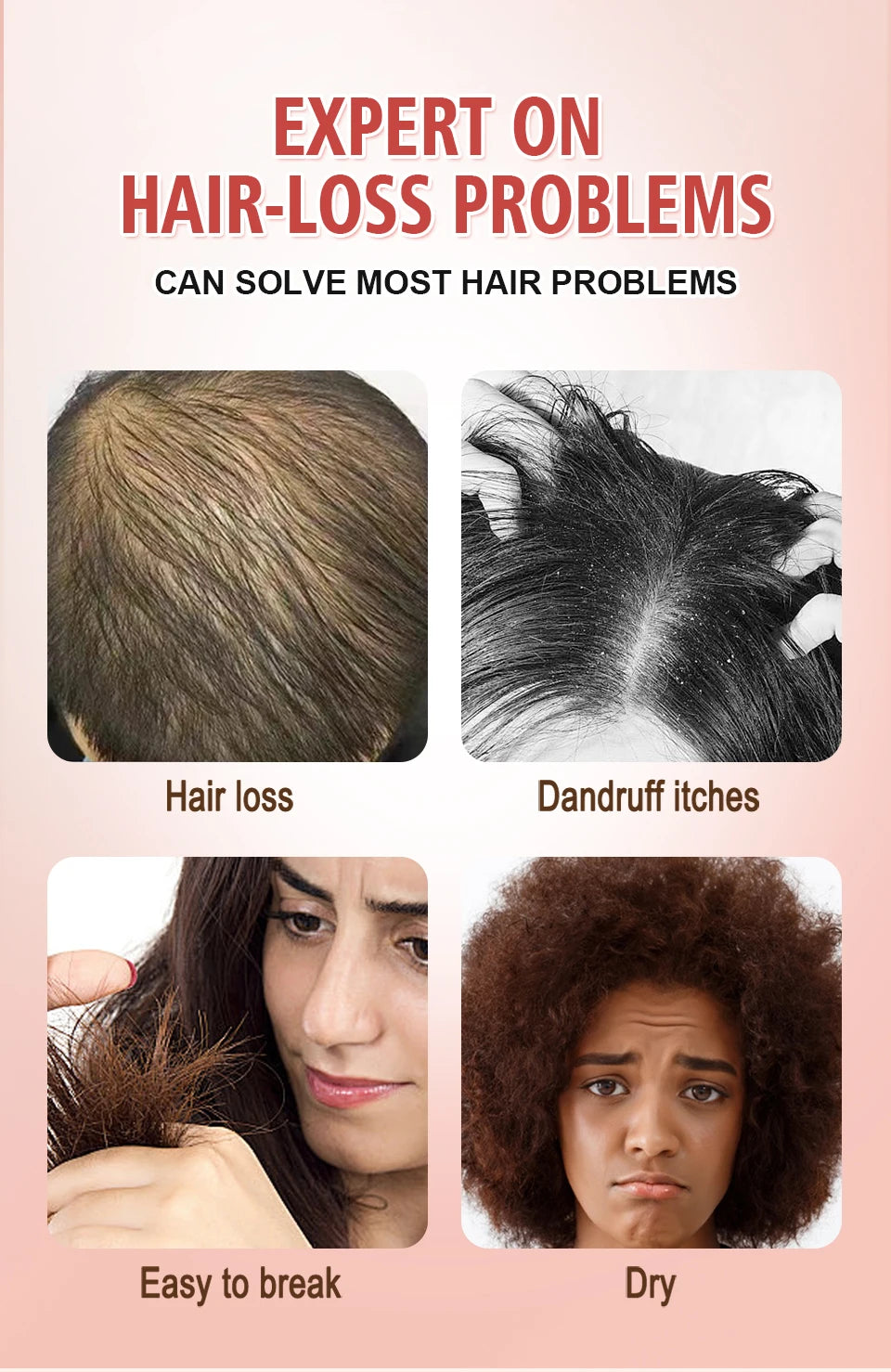Naturals Anti-Hair Loss Oil Super 5x set African fast hair growth Chebe Batana oil butter  Fenugreek hair regrowth treatment